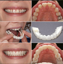 Load image into Gallery viewer, Flex Cosmetic Full Set Teeth